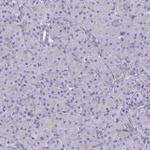 TEKT3 Polyclonal Antibody
