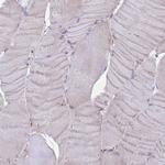 UAP1L1 Antibody in Immunohistochemistry (Paraffin) (IHC (P))