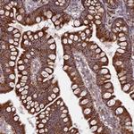 UAP1L1 Antibody in Immunohistochemistry (Paraffin) (IHC (P))