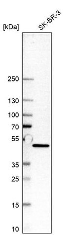 UAP1L1 Antibody in Western Blot (WB)
