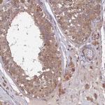 INCA1 Polyclonal Antibody