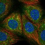 USP32 Polyclonal Antibody