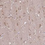 USP32 Antibody in Immunohistochemistry (Paraffin) (IHC (P))