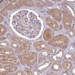 USP32 Antibody in Immunohistochemistry (Paraffin) (IHC (P))