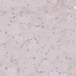 USP32 Antibody in Immunohistochemistry (Paraffin) (IHC (P))