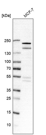 USP32 Antibody in Western Blot (WB)