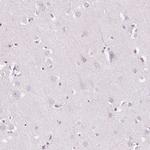 GAS2L2 Antibody in Immunohistochemistry (Paraffin) (IHC (P))