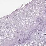 GAS2L2 Polyclonal Antibody