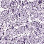 GAS2L2 Antibody in Immunohistochemistry (Paraffin) (IHC (P))