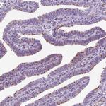 GAS2L2 Antibody in Immunohistochemistry (IHC)