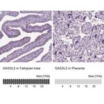 GAS2L2 Antibody