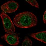 ZNF623 Antibody in Immunocytochemistry (ICC/IF)