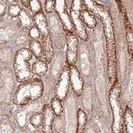 ZNF623 Antibody in Immunohistochemistry (Paraffin) (IHC (P))