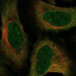 ZNF329 Polyclonal Antibody