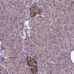 ZNF329 Antibody in Immunohistochemistry (Paraffin) (IHC (P))
