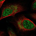 GPATCH8 Polyclonal Antibody