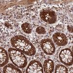 GPATCH8 Antibody in Immunohistochemistry (Paraffin) (IHC (P))