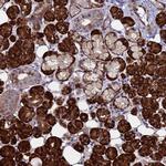 NOSTRIN Antibody in Immunohistochemistry (IHC)