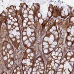 ABHD1 Antibody in Immunohistochemistry (Paraffin) (IHC (P))