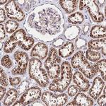 LACTB2 Antibody in Immunohistochemistry (Paraffin) (IHC (P))