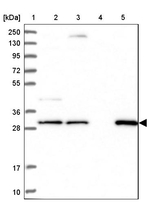 LACTB2 Antibody in Western Blot (WB)