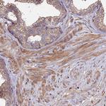 EXT1 Polyclonal Antibody