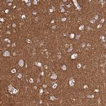 CASD1 Antibody in Immunohistochemistry (Paraffin) (IHC (P))