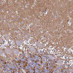 CASD1 Antibody in Immunohistochemistry (Paraffin) (IHC (P))