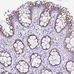 CASD1 Antibody in Immunohistochemistry (Paraffin) (IHC (P))