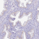 CASD1 Antibody in Immunohistochemistry (Paraffin) (IHC (P))