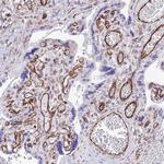 ZNF652 Antibody in Immunohistochemistry (IHC)