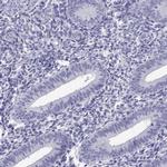 C17orf64 Antibody in Immunohistochemistry (IHC)