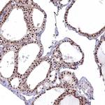 MAK16 Polyclonal Antibody