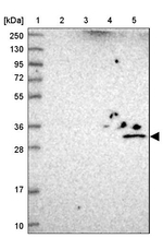 UTP23 Antibody in Western Blot (WB)