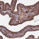 C8orf34 Antibody in Immunohistochemistry (Paraffin) (IHC (P))