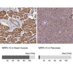 MRPL15 Polyclonal Antibody