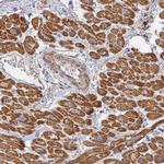 MRPL15 Antibody in Immunohistochemistry (IHC)
