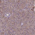 MRPL15 Antibody in Immunohistochemistry (IHC)