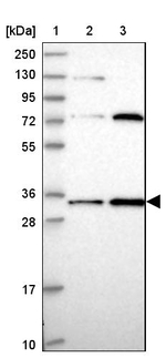 MRPL15 Antibody in Western Blot (WB)