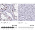 PSMC3IP Antibody
