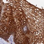 ZNF628 Antibody in Immunohistochemistry (Paraffin) (IHC (P))