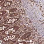 SHARPIN Antibody in Immunohistochemistry (Paraffin) (IHC (P))