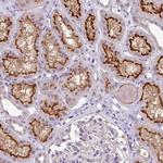 TMEM62 Polyclonal Antibody