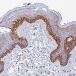 MROH1 Polyclonal Antibody