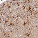 MROH1 Antibody in Immunohistochemistry (IHC)