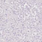 SPRR3 Antibody in Immunohistochemistry (Paraffin) (IHC (P))