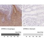 SPRR3 Antibody in Immunohistochemistry (IHC)