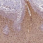 SPRR3 Antibody in Immunohistochemistry (IHC)