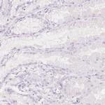 SPRR3 Antibody in Immunohistochemistry (IHC)