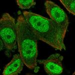 MYST2 Polyclonal Antibody